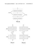 Stent diagram and image