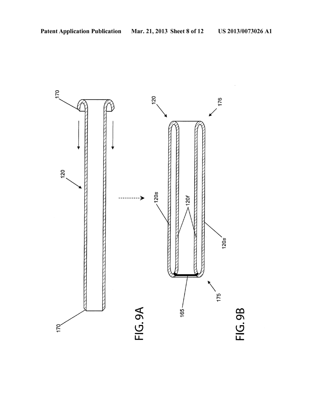 DEVICE AND METHOD FOR TREATING VASCULAR ABNORMALITIES - diagram, schematic, and image 09