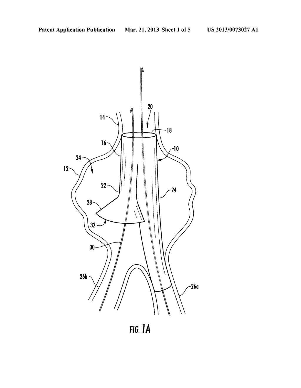 STENT GRAFT WITH FLANGED CONTRALATERAL GATE FOR ENDOVASCULAR ANEURYSM     REPAIR - diagram, schematic, and image 02