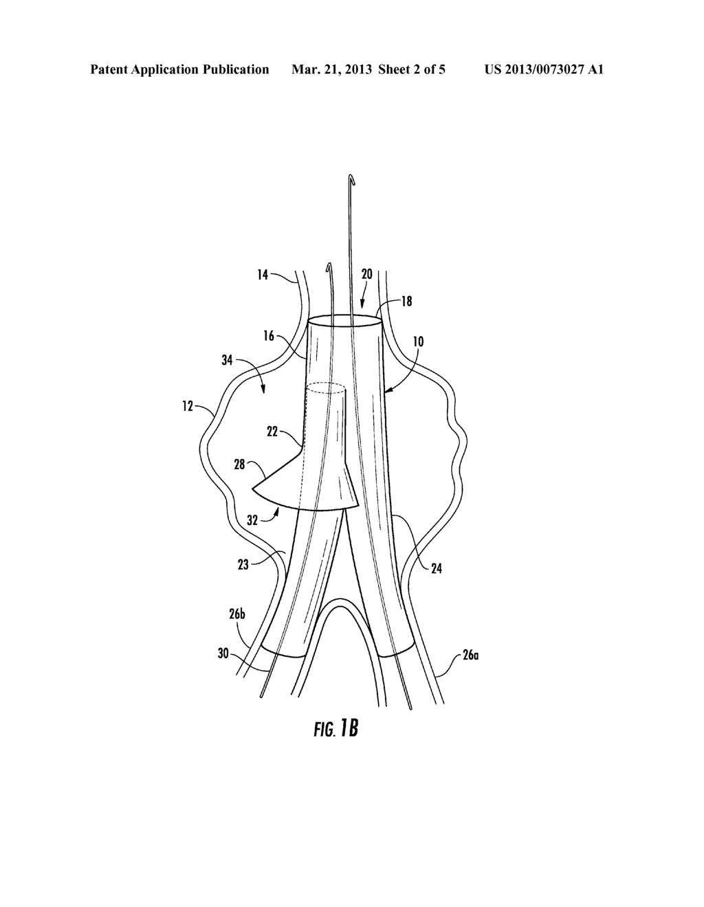 STENT GRAFT WITH FLANGED CONTRALATERAL GATE FOR ENDOVASCULAR ANEURYSM     REPAIR - diagram, schematic, and image 03