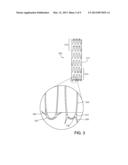 MEDICAL DEVICE FIXATION ANCHORS diagram and image