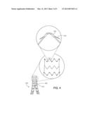 MEDICAL DEVICE FIXATION ANCHORS diagram and image