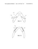 MEDICAL DEVICE FIXATION ANCHORS diagram and image