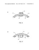 SYSTEMS AND METHODS FOR HOLDING ANNULOPLASTY RINGS diagram and image