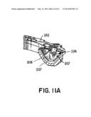 SYSTEMS AND METHODS FOR HOLDING ANNULOPLASTY RINGS diagram and image