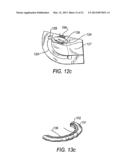 SYSTEMS AND METHODS FOR HOLDING ANNULOPLASTY RINGS diagram and image