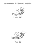 SYSTEMS AND METHODS FOR HOLDING ANNULOPLASTY RINGS diagram and image