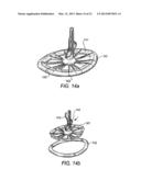 SYSTEMS AND METHODS FOR HOLDING ANNULOPLASTY RINGS diagram and image