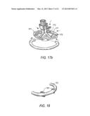 SYSTEMS AND METHODS FOR HOLDING ANNULOPLASTY RINGS diagram and image