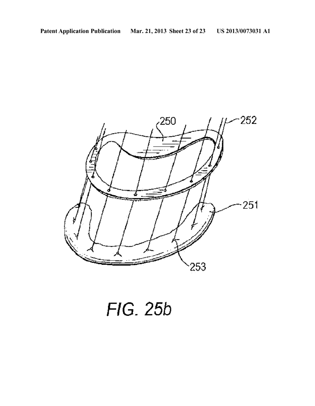 SYSTEMS AND METHODS FOR HOLDING ANNULOPLASTY RINGS - diagram, schematic, and image 24