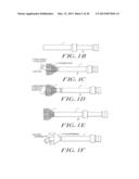 Cardiac Valve Procedure Methods and Devices diagram and image