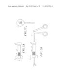 Cardiac Valve Procedure Methods and Devices diagram and image