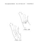 Cardiac Valve Procedure Methods and Devices diagram and image