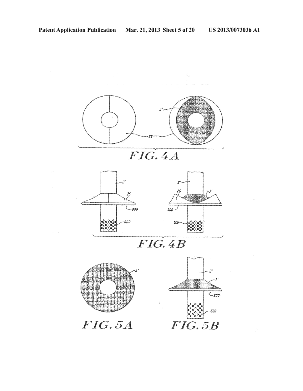 Cardiac Valve Procedure Methods and Devices - diagram, schematic, and image 06