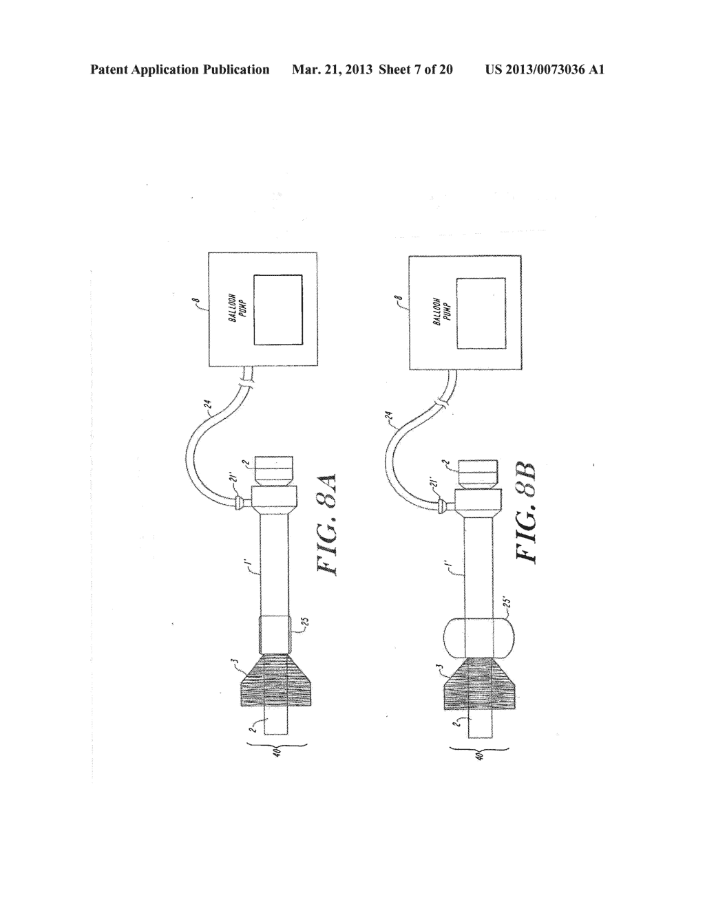 Cardiac Valve Procedure Methods and Devices - diagram, schematic, and image 08