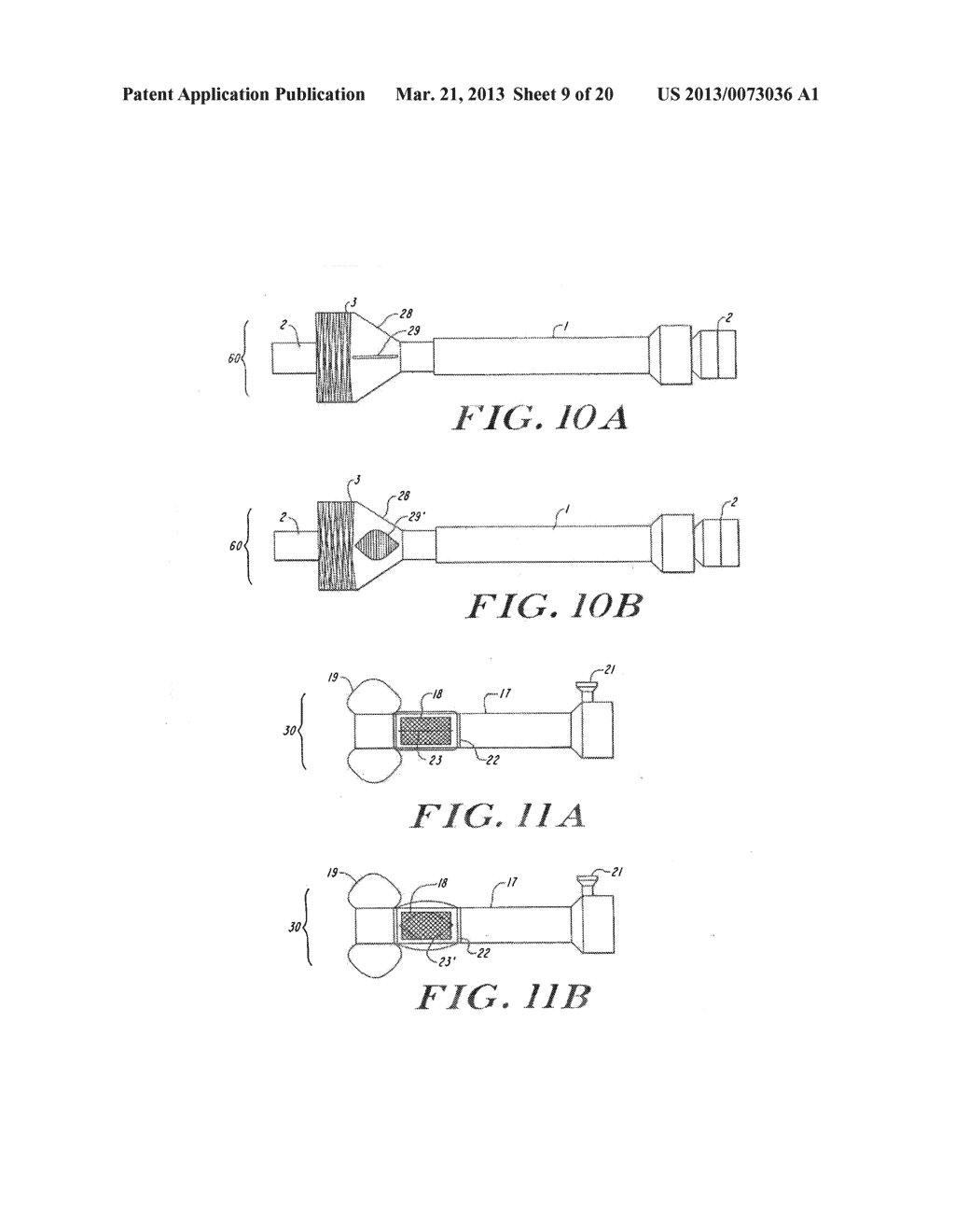 Cardiac Valve Procedure Methods and Devices - diagram, schematic, and image 10