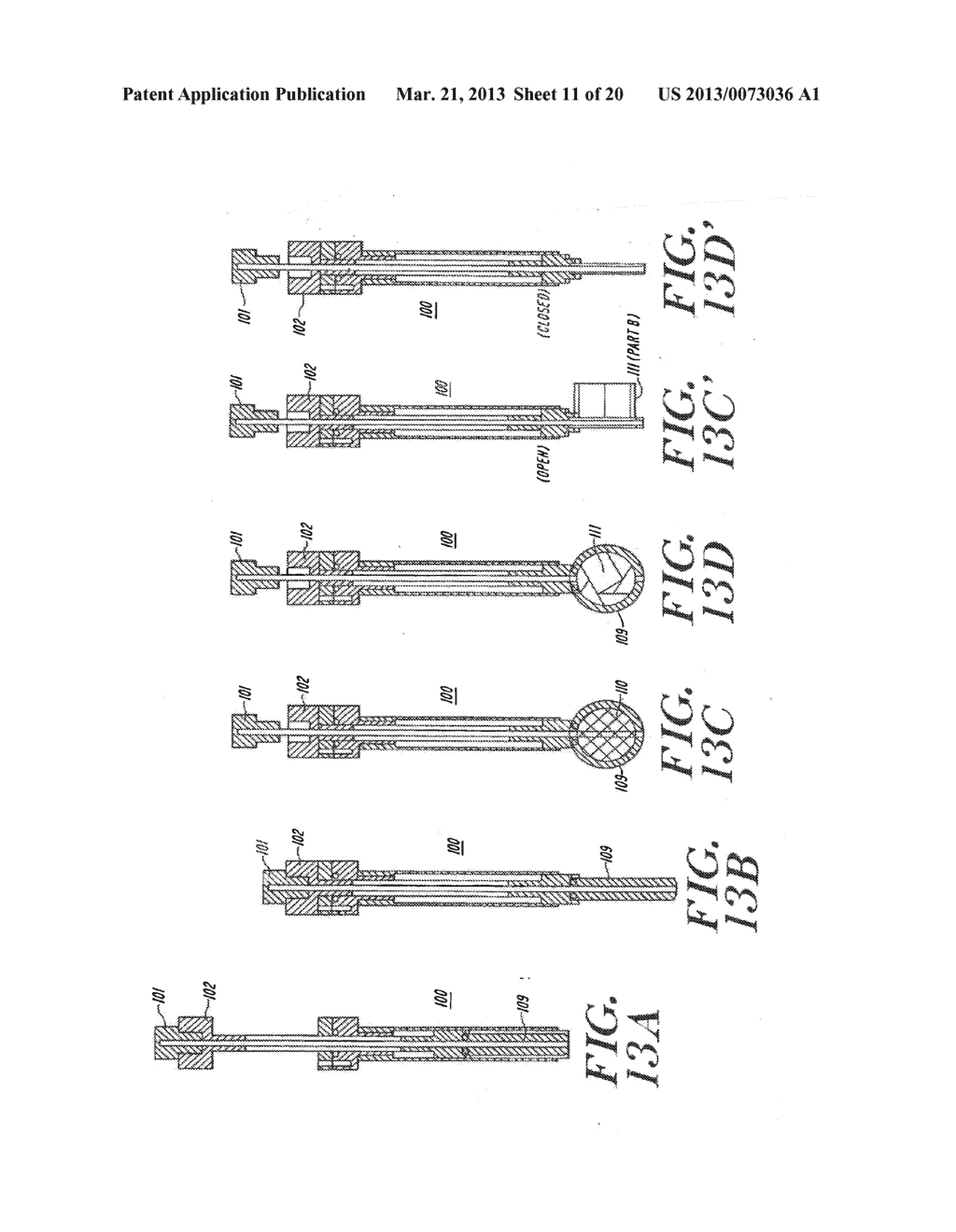 Cardiac Valve Procedure Methods and Devices - diagram, schematic, and image 12