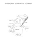 Cardiac Valve Procedure Methods and Devices diagram and image