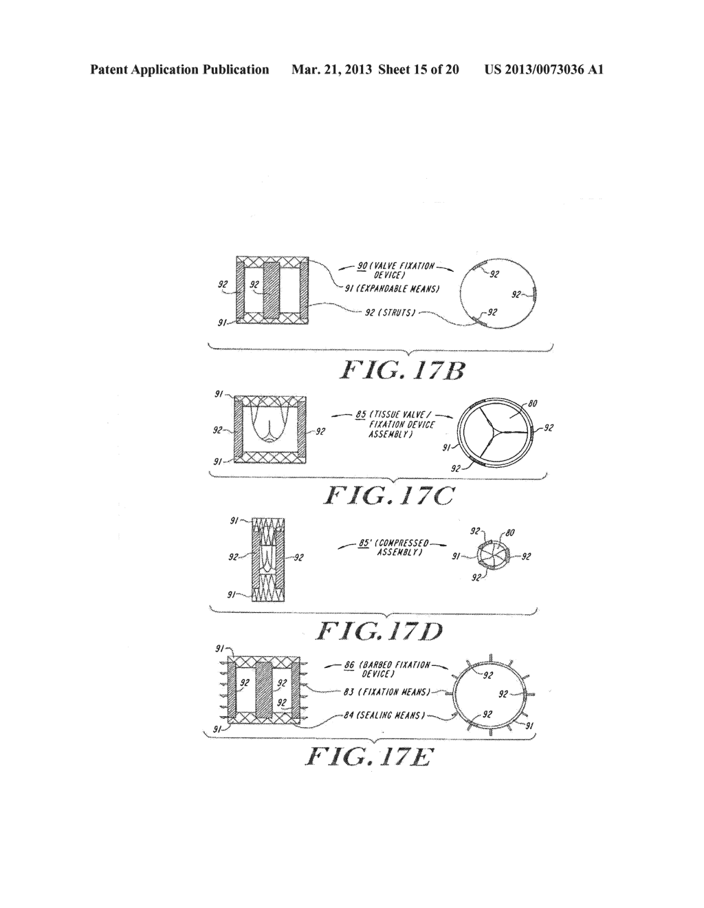 Cardiac Valve Procedure Methods and Devices - diagram, schematic, and image 16