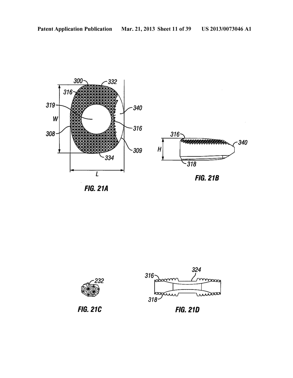 Multi-piece Intervertebral Implants - diagram, schematic, and image 12