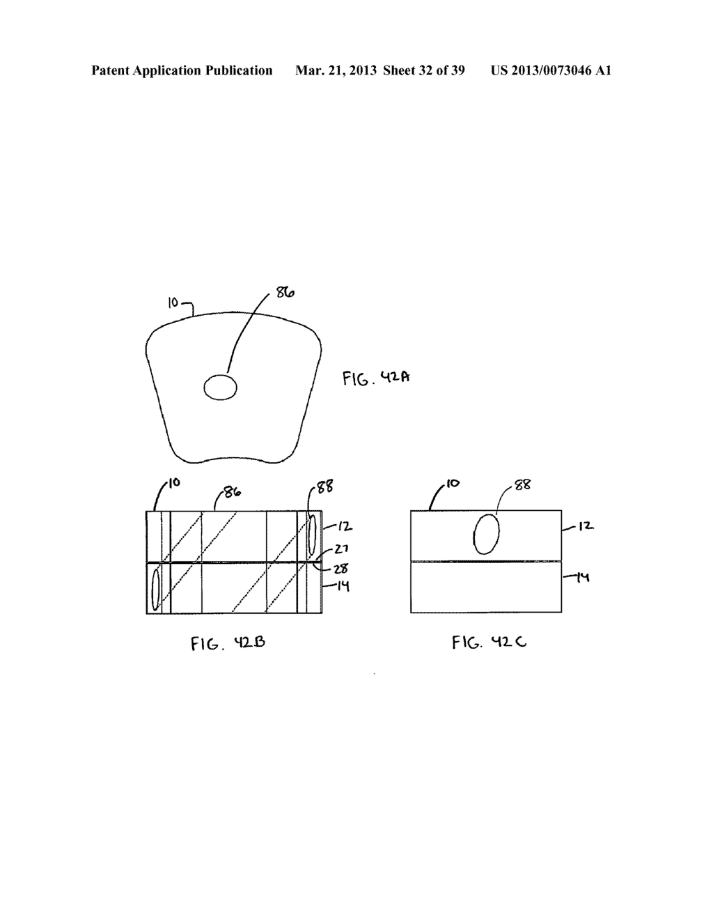 Multi-piece Intervertebral Implants - diagram, schematic, and image 33