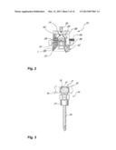 METHOD AND SYSTEM FOR PLANNING/GUIDING ALTERATIONS TO A BONE diagram and image