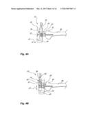 METHOD AND SYSTEM FOR PLANNING/GUIDING ALTERATIONS TO A BONE diagram and image