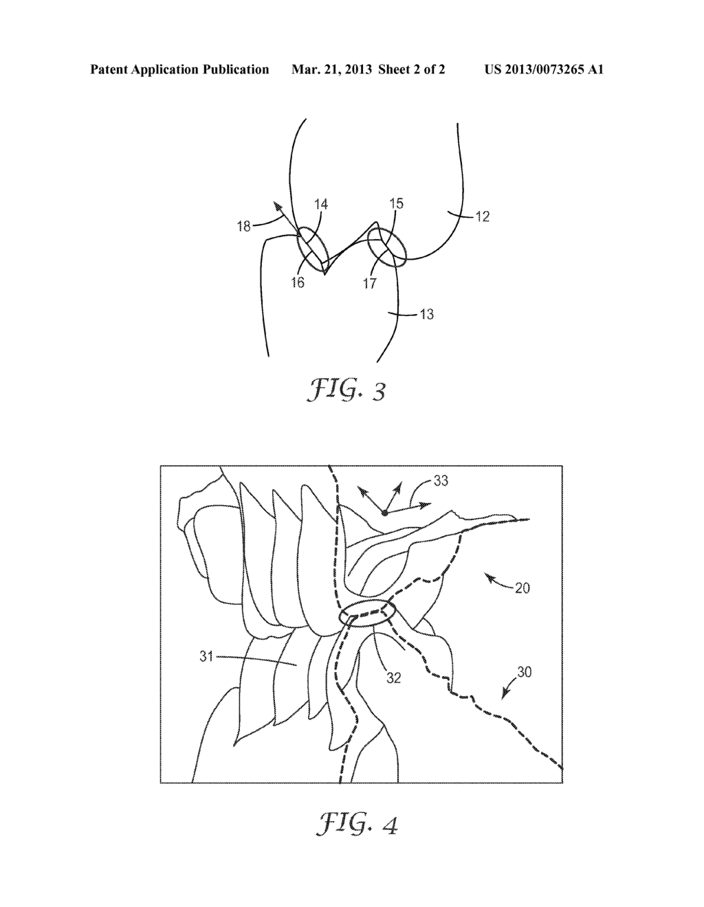 METHOD IN THE MAKING OF A DENTAL RESTORATION - diagram, schematic, and image 03