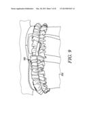 BELT diagram and image