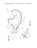 Cylindrical Dedusting Apparatus for Particulate Material diagram and image