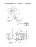 LENGTH ADJUSTING MECHANISM FOR AN ELONGATE STRAP diagram and image