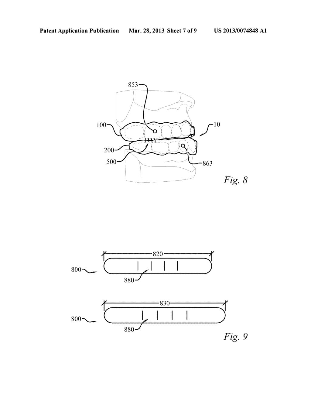 ANTI-OBSTRUCTIVE AIRWAY DENTAL ORTHOTIC - diagram, schematic, and image 08