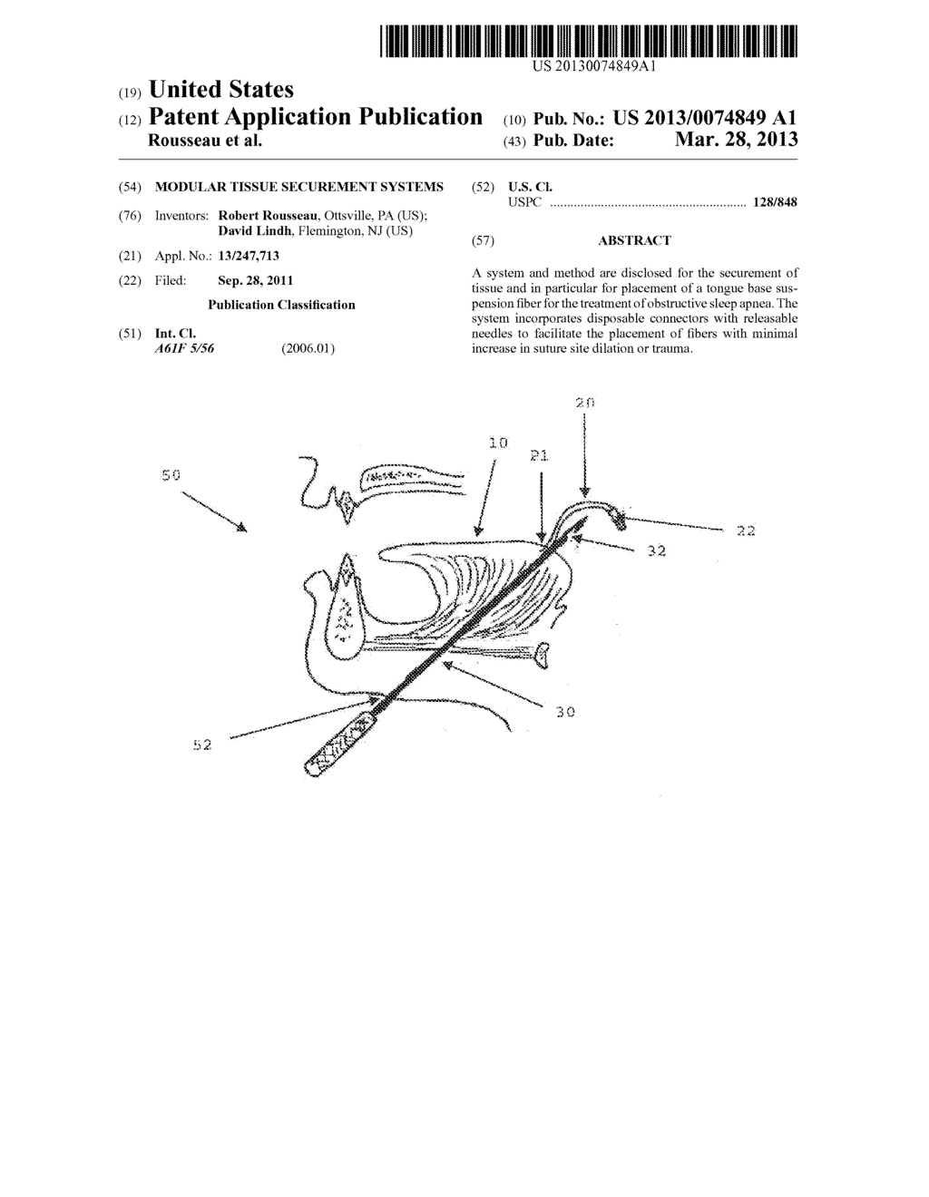 Modular Tissue Securement Systems - diagram, schematic, and image 01