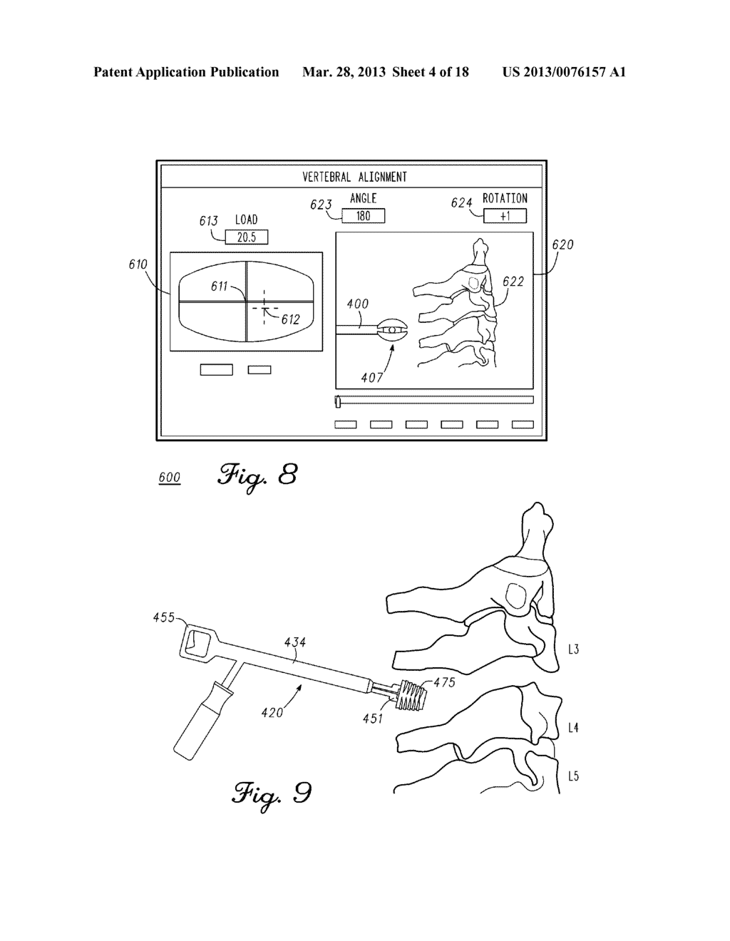 DEVICE AND METHOD FOR ENABLING AN ORTHOPEDIC TOOL FOR PARAMETER     MEASUREMENT - diagram, schematic, and image 05