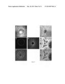 NORMALIZATION OF RETINAL NERVE FIBER LAYER THICKNESS MEASUREMENTS MADE BY     TIME DOMAIN-OPTICAL COHERENCE TOMOGRAPHY diagram and image