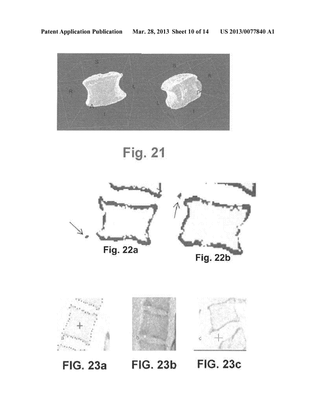 Automated Vertebral Body Image Segmentation for Medical Screening - diagram, schematic, and image 11