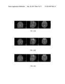 Doseless Emission Tomography Attenuation Correction diagram and image
