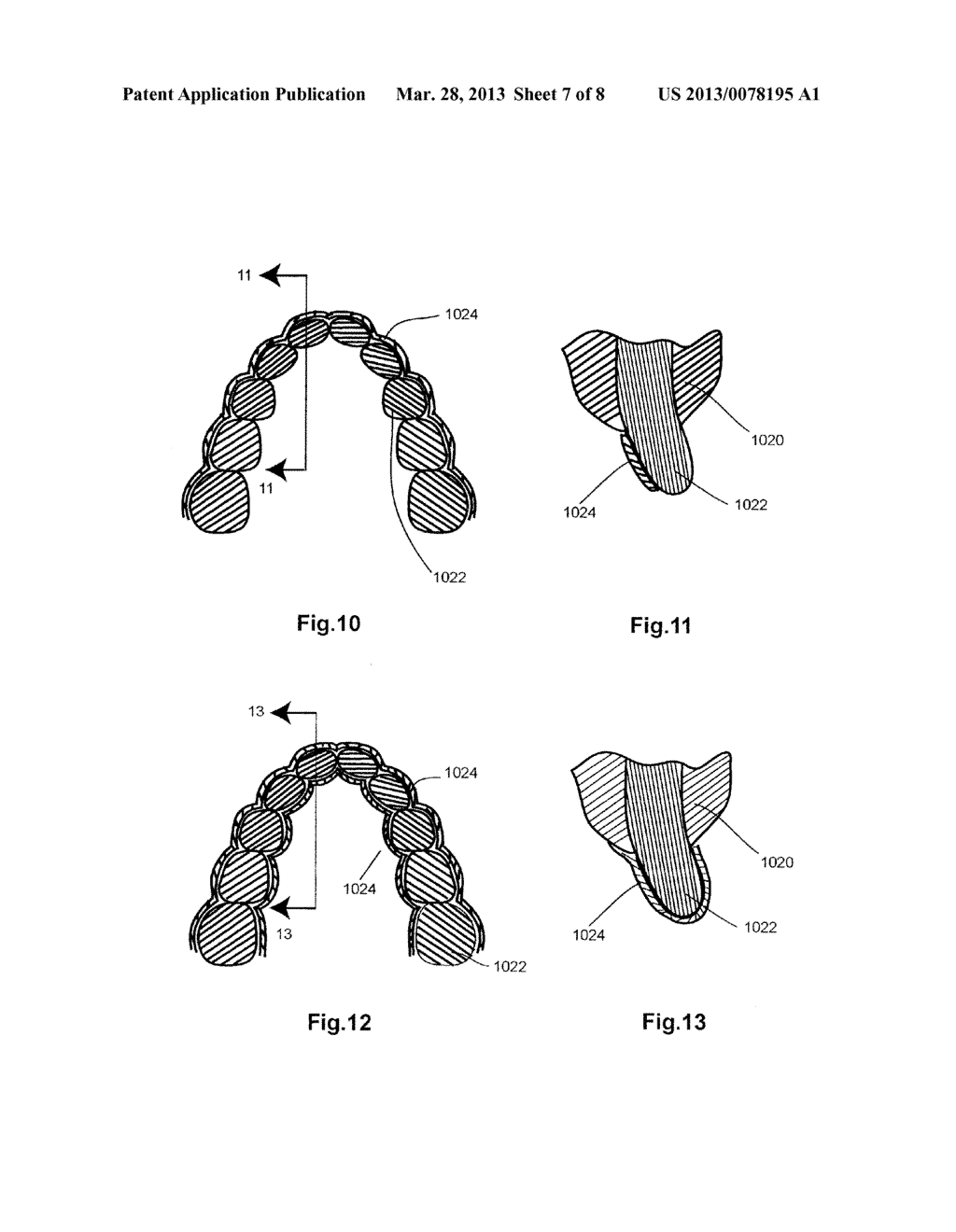 ADHESIVE DENTAL BLEACHING COMPOSITIONS CONTAINING POLYVINYLPYRROLIDONE - diagram, schematic, and image 08