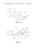 APPARATUS FOR REMOVING DENTAL APPLIANCE AND DENTAL SYSTEM diagram and image