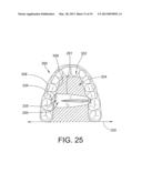 APPARATUS FOR REMOVING DENTAL APPLIANCE AND DENTAL SYSTEM diagram and image