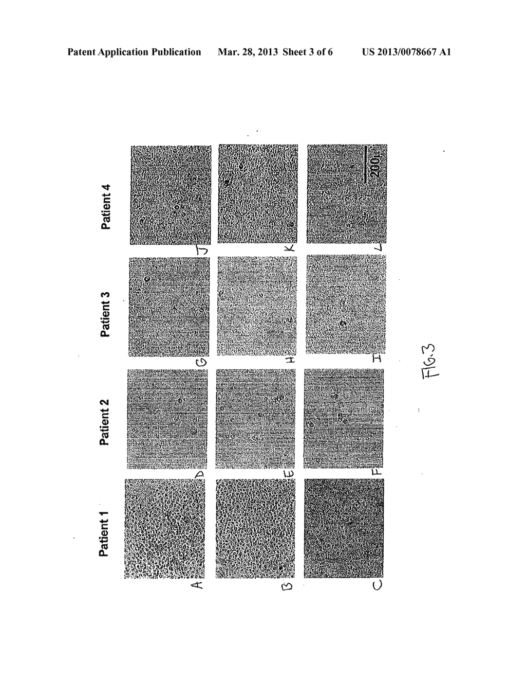 METHODS FOR DETECTING AND COLLECTING CIRCULATING TUMOR CELLS - diagram, schematic, and image 04