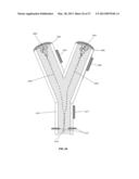 PARTICLE QUANTIFYING SYSTEMS AND METHODS USING ACOUSTIC RADIATION PRESSURE diagram and image