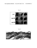 CAFFEOYLALPHANEOENDORPHIN PEPTIDE DERIVATIVE AND USE THEREOF AS     ANTI-ITCHING AND ANTI-ATOPIC AGENTS diagram and image