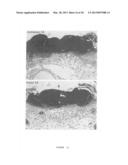 FORMULATIONS COMPRISING ANTISENSE NUCLEOTIDES TO CONNEXINS diagram and image