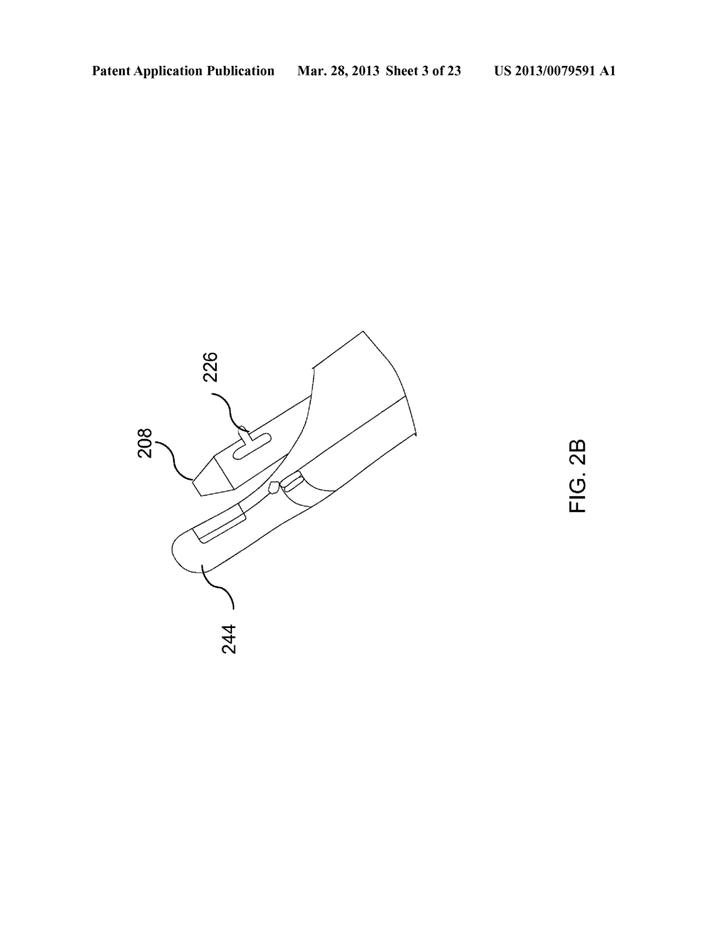 MEDICAL DEVICE FOR DELIVERY OF BODILY IMPLANTS - diagram, schematic, and image 04