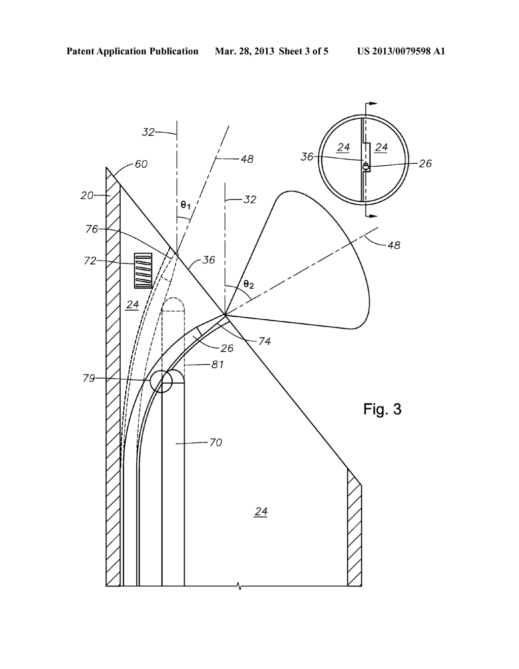 Ophthalmic endoilluminators with directed light - diagram, schematic, and image 04