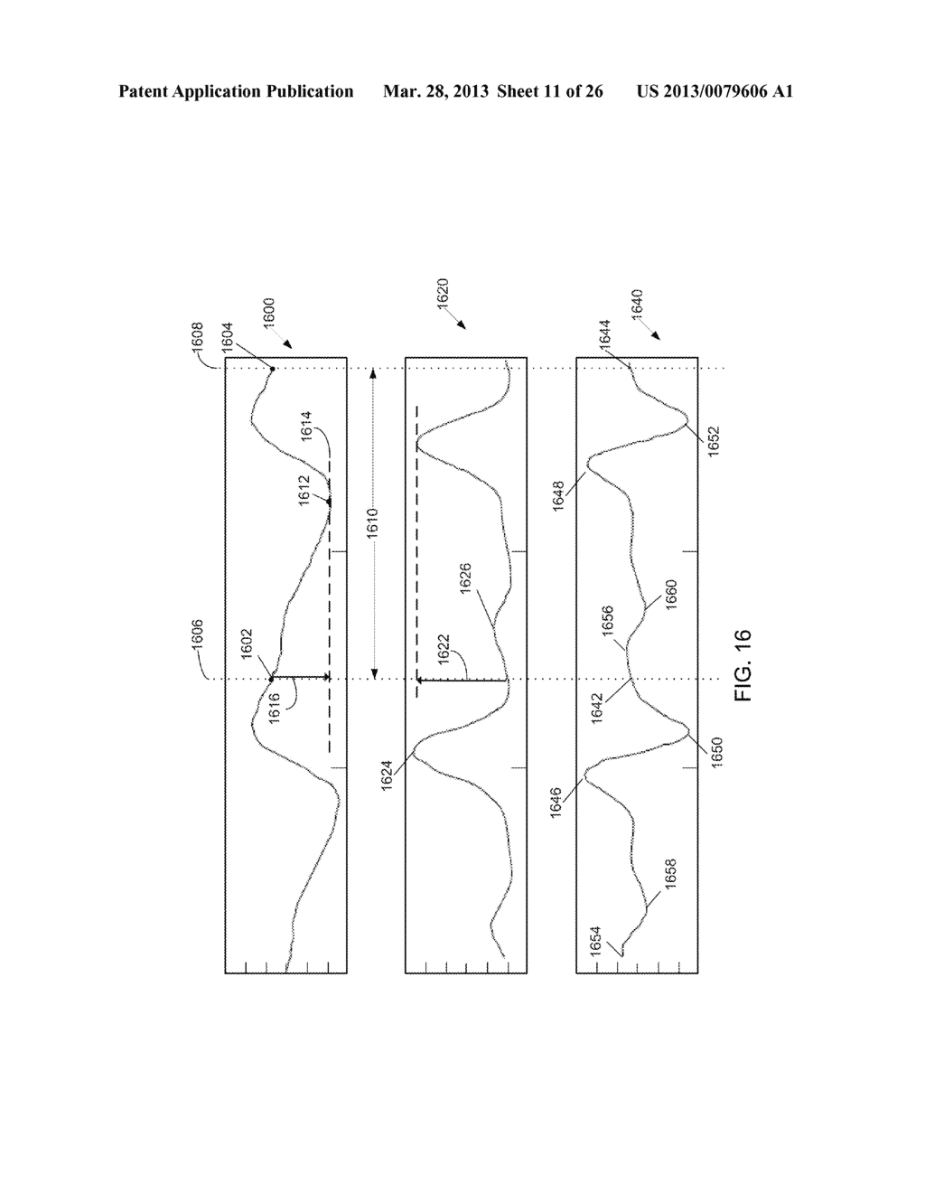 SYSTEMS AND METHODS FOR DETERMINING RESPIRATION INFORMATION FROM A     PHOTOPLETHYSMOGRAPH - diagram, schematic, and image 12