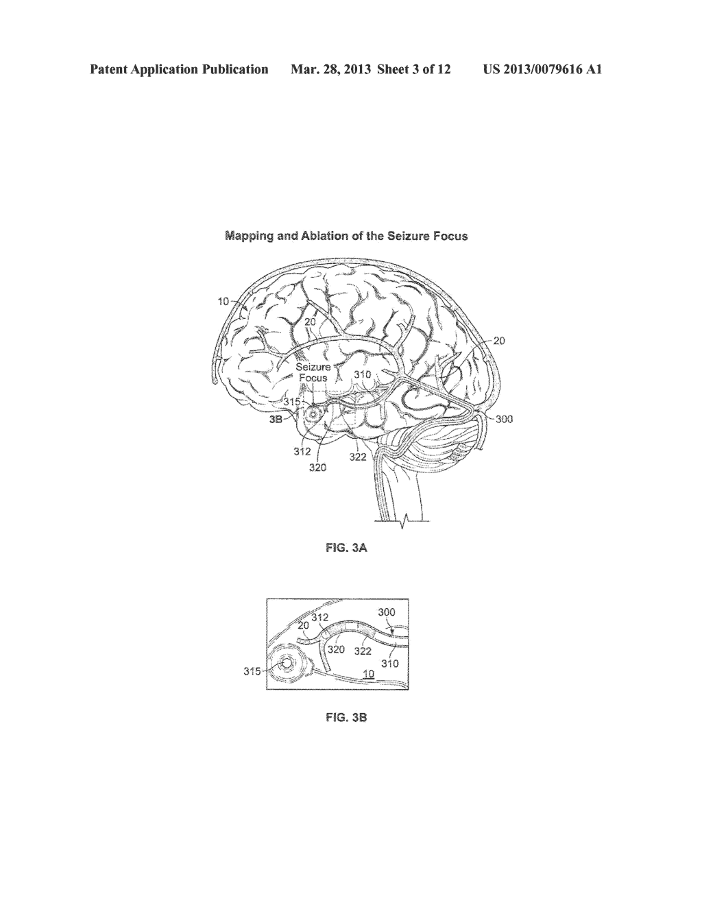 DETECTING AND TREATING NERVOUS SYSTEM DISORDERS - diagram, schematic, and image 04