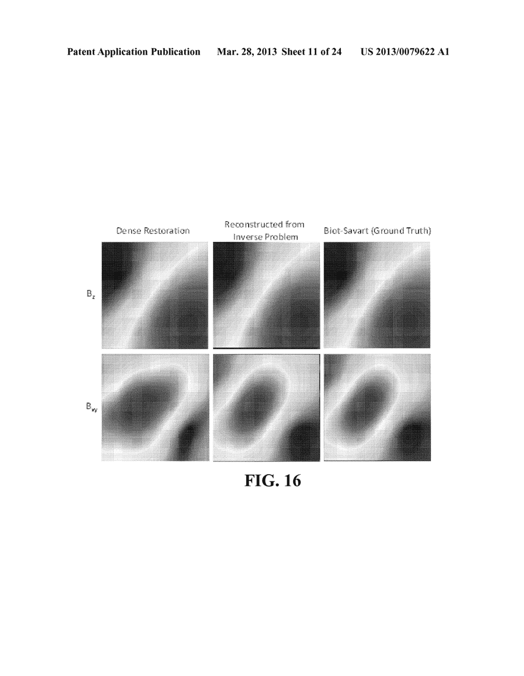 Denoise MCG Measurements - diagram, schematic, and image 12