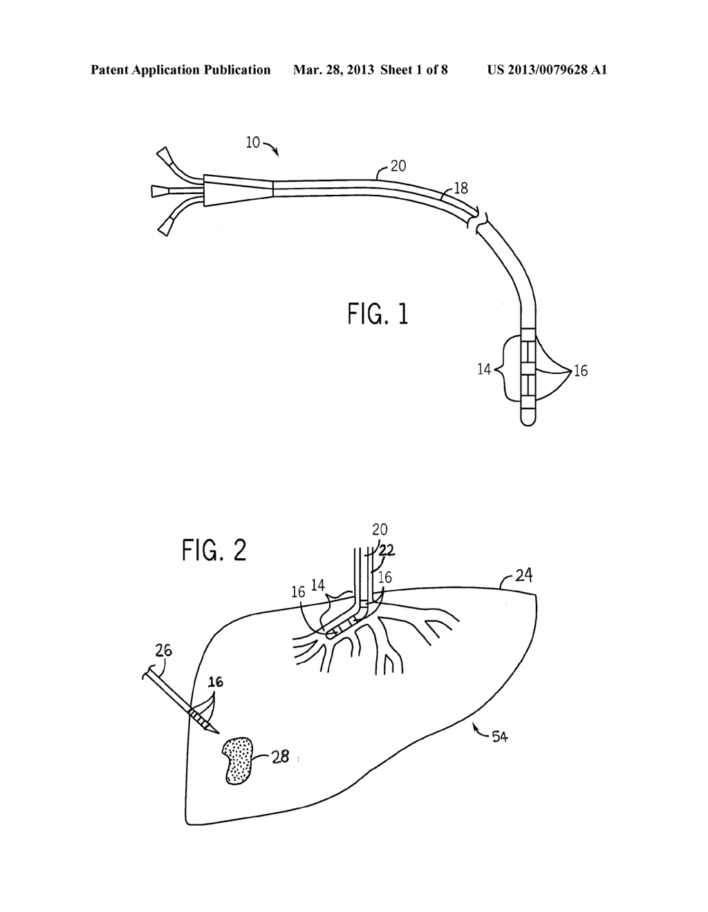 DYNAMIC REFERENCE METHOD AND SYSTEM FOR INTERVENTIONAL PROCEDURES - diagram, schematic, and image 02